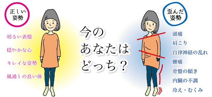 身体の歪みイラスト