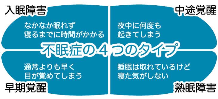 不眠症4タイプ画像
